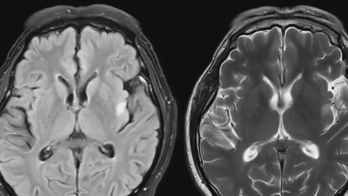 The 'Why' Angle | Why Understanding CTE Matters to Everyone