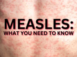 Measles Outbreak