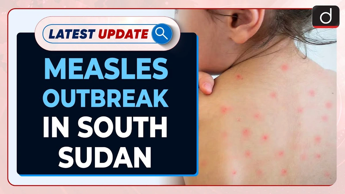 The Alarming Rise of Measles Cases