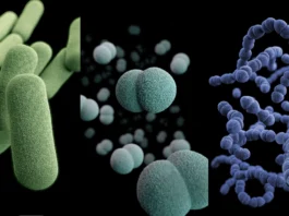 bacterial meningitis