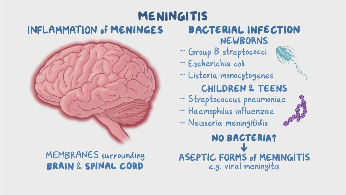 The "Why" | Understanding Bacterial Meningitis