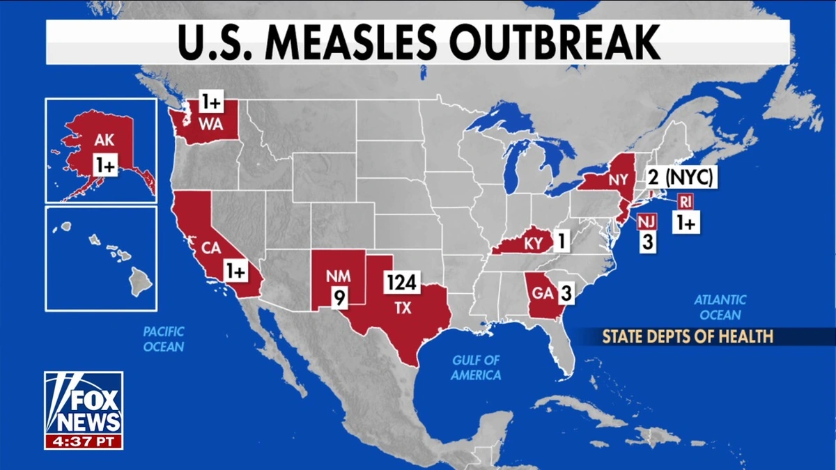 Why Are Measles Cases Surging? The Real Story