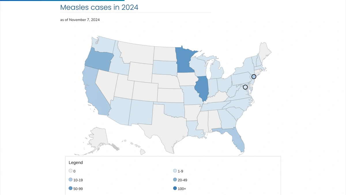Why Are Measles Outbreaks Happening… Again?